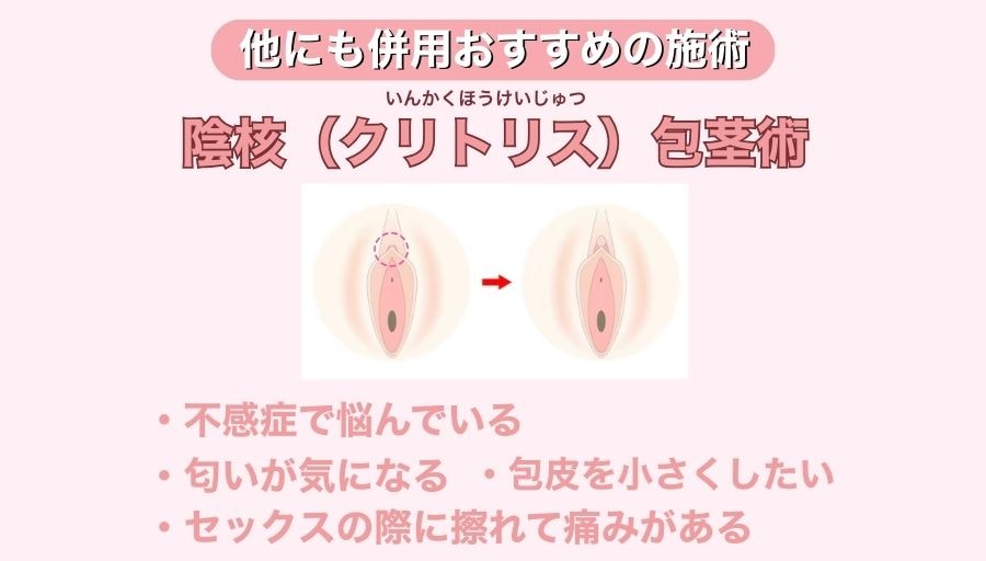 陰核（クリトリス）包茎術